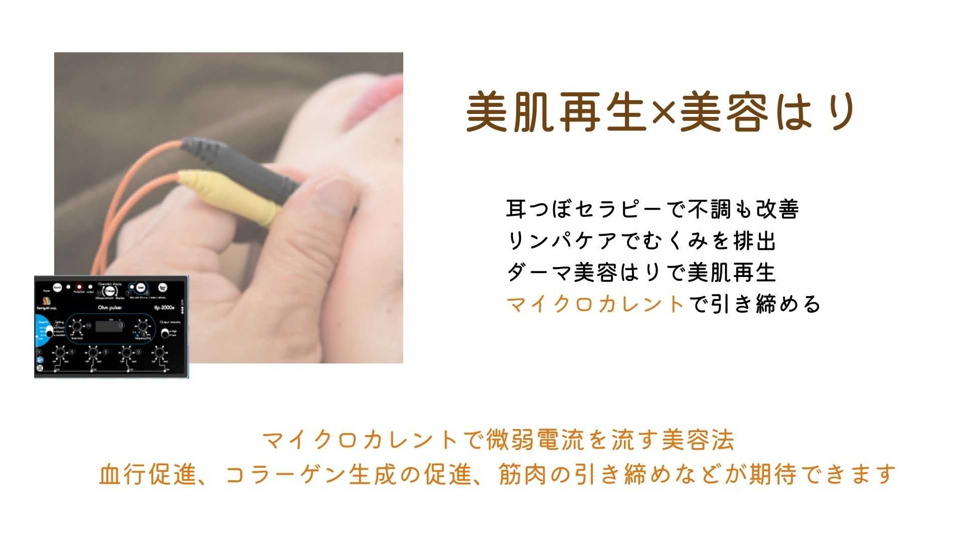 ダーマローラー美容鍼